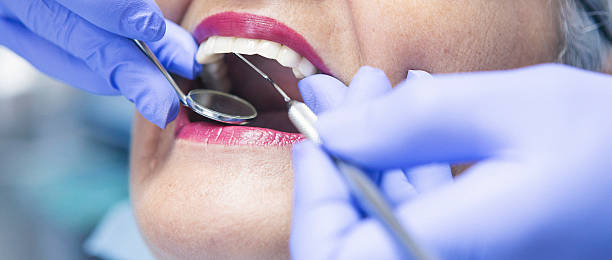 Best Emergency Gum Treatment in Goulding, FL